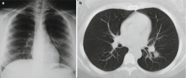 Fig. 20.10