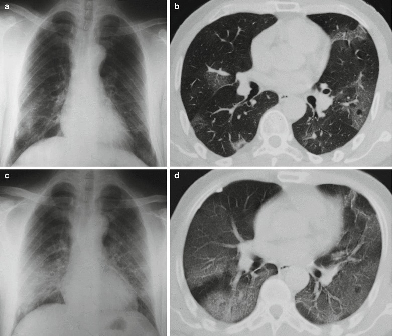 Fig. 20.23