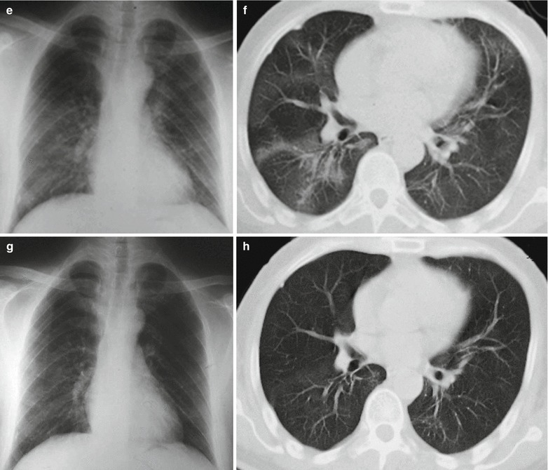 Fig. 20.23