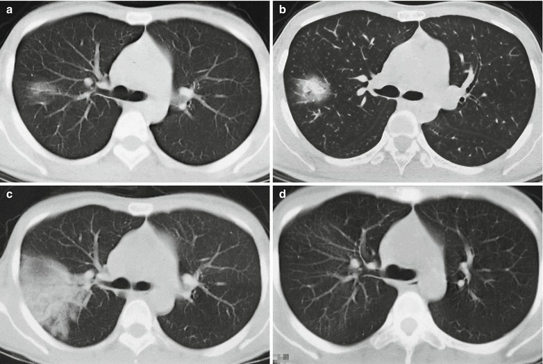 Fig. 20.22