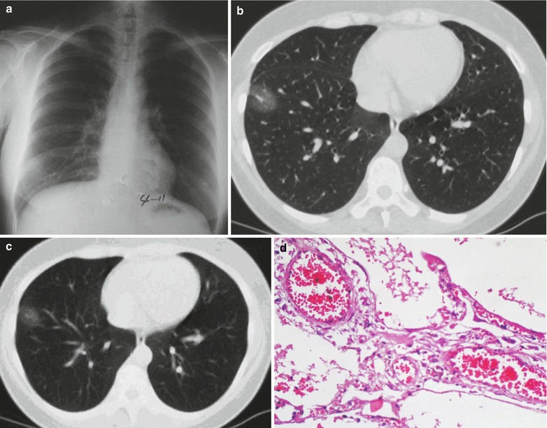 Fig. 20.9