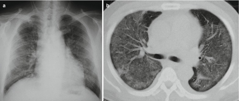 Fig. 20.26