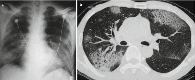 Fig. 20.25