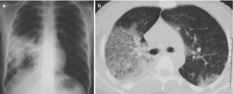 Fig. 20.27