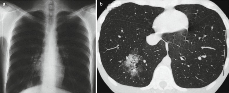 Fig. 20.12
