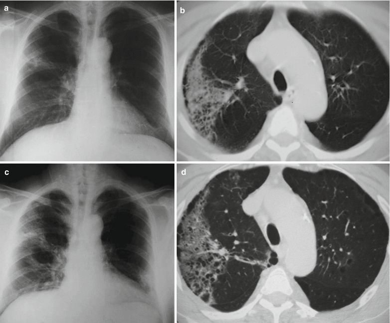 Fig. 20.24