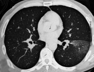 Fig. 20.20