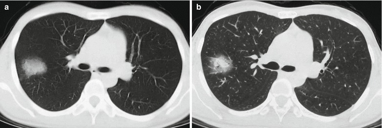 Fig. 20.14