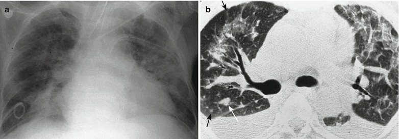 Fig. 20.34