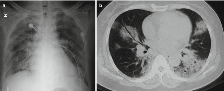 Fig. 20.33