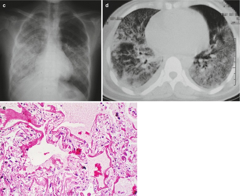 Fig. 20.27