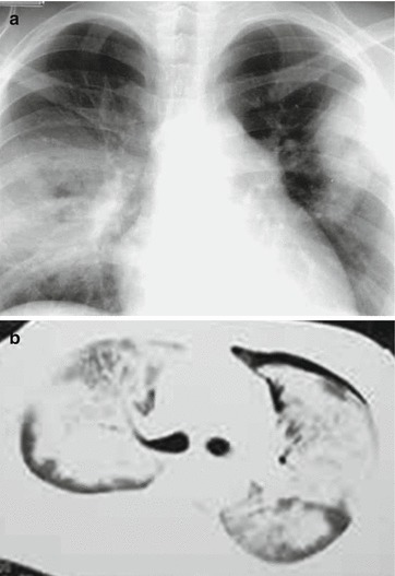 Fig. 20.37
