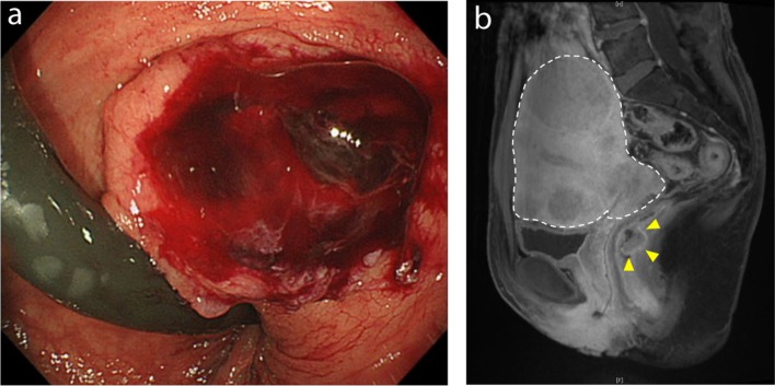 Fig. 2