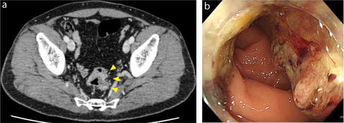 Fig. 1