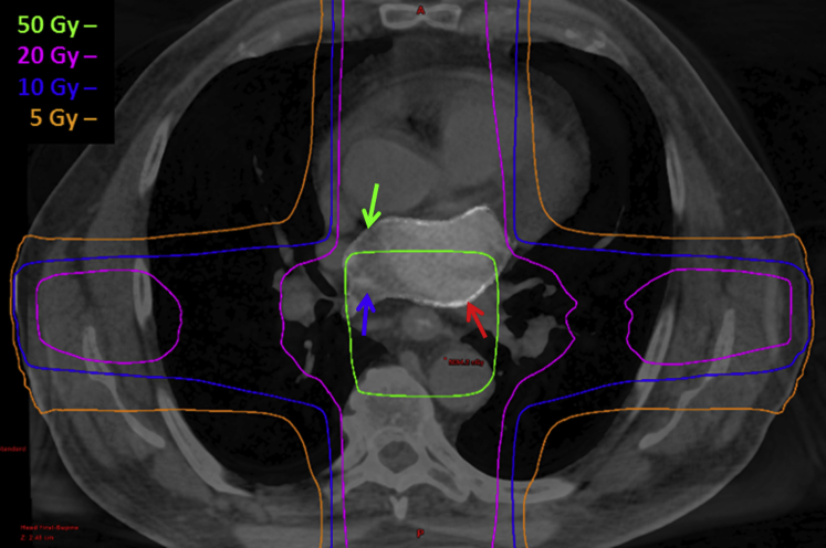 Figure 2