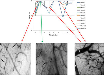 Fig. 1 (abstract P120).