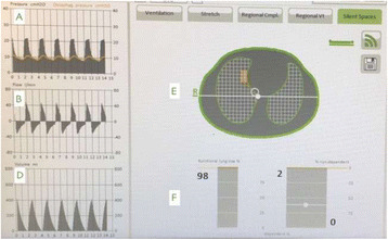 Fig. 1 (abstract P218).