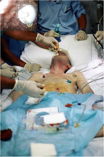 Fig. 1 (abstract P496).