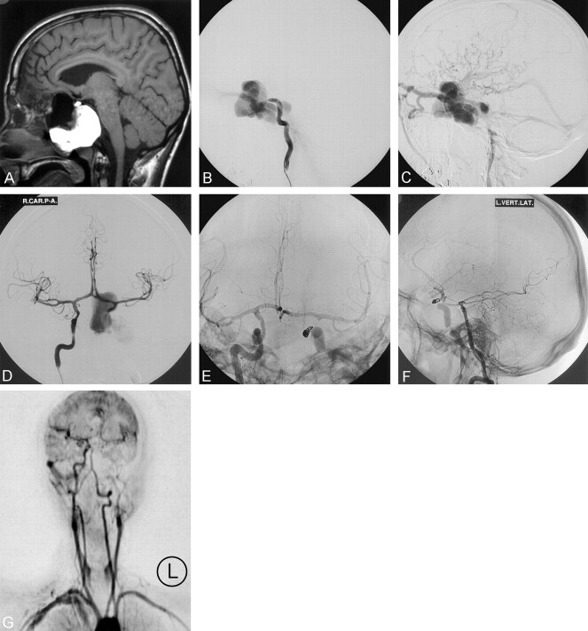 Fig 1.