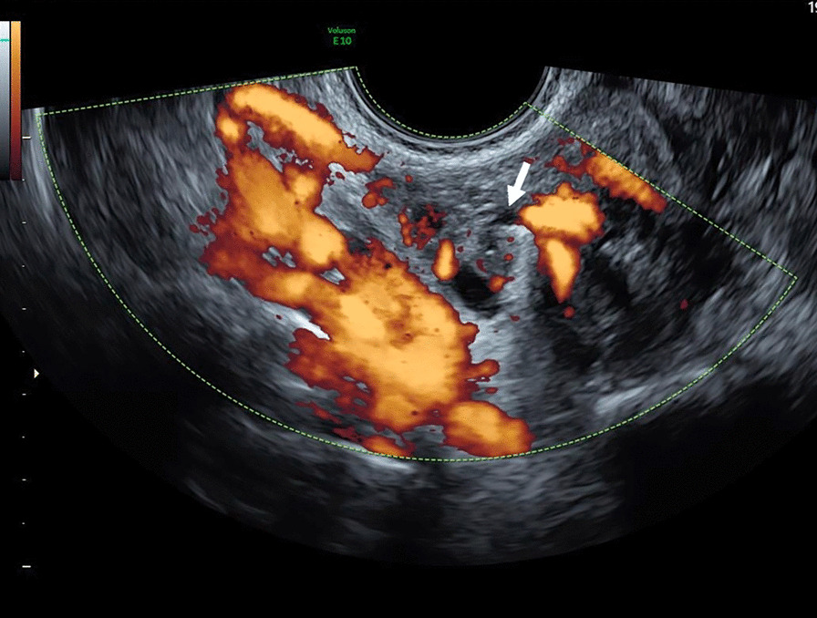 Fig. 2