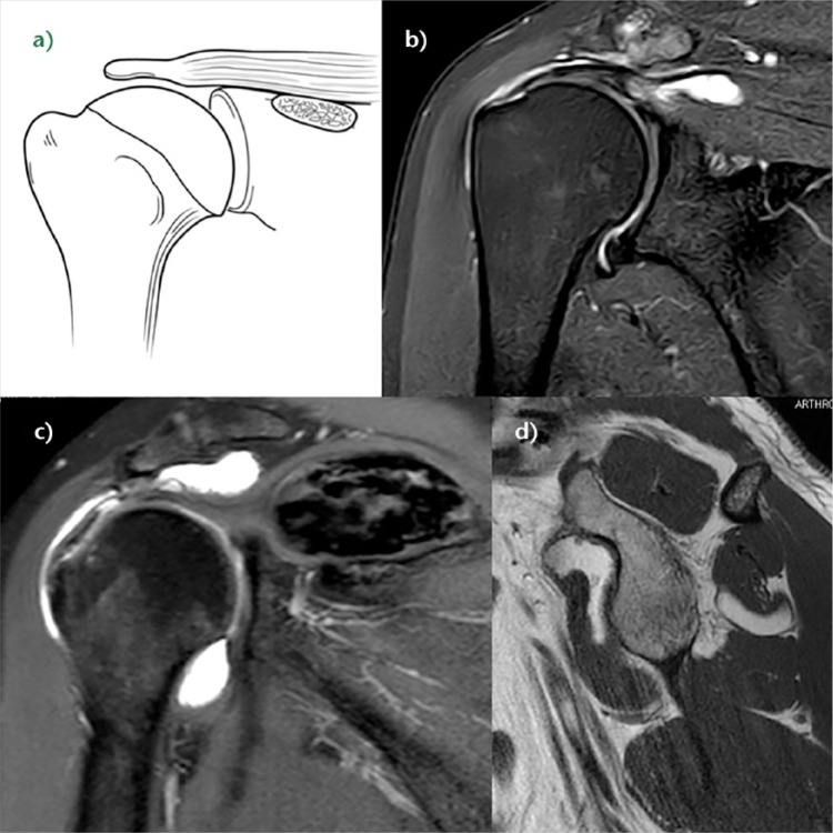 Fig. 10