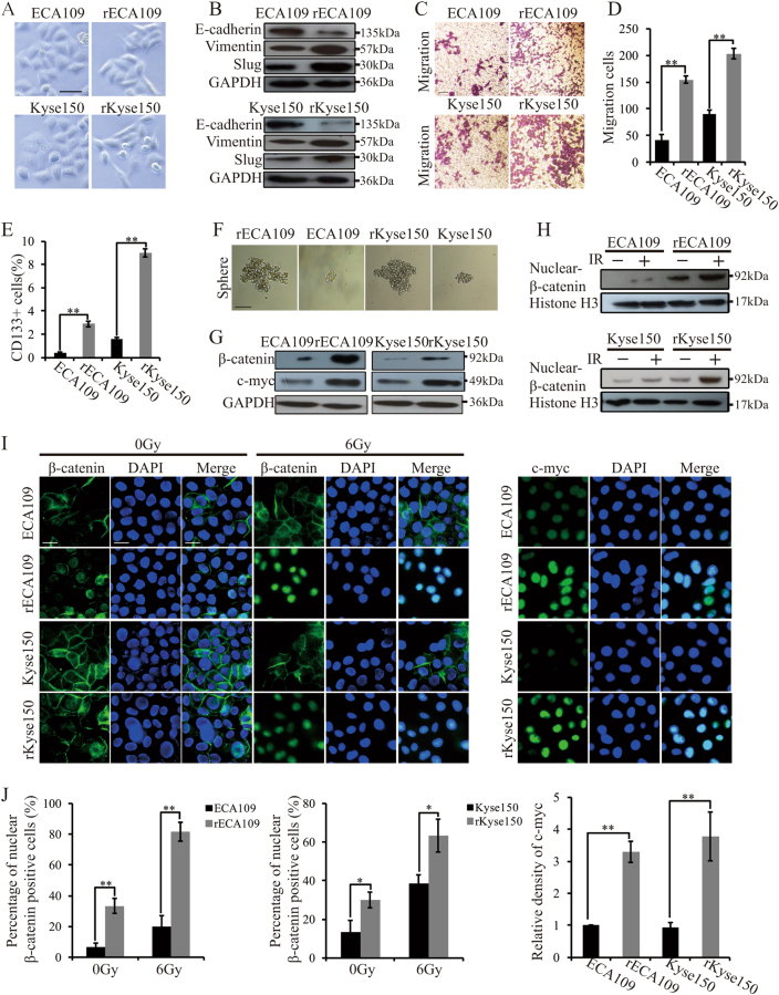 Fig. 2 Radioresistant cells acquired EMT properties, characteristic associated with cancer stem cells and higher Wnt signaling activity.