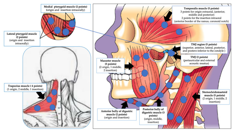 Figure 13