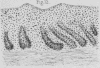 150-5
