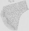 150-5