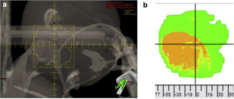 Figure 1