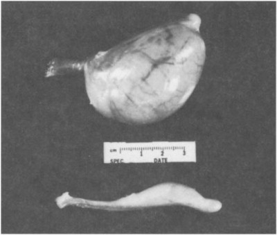 Fig. 16