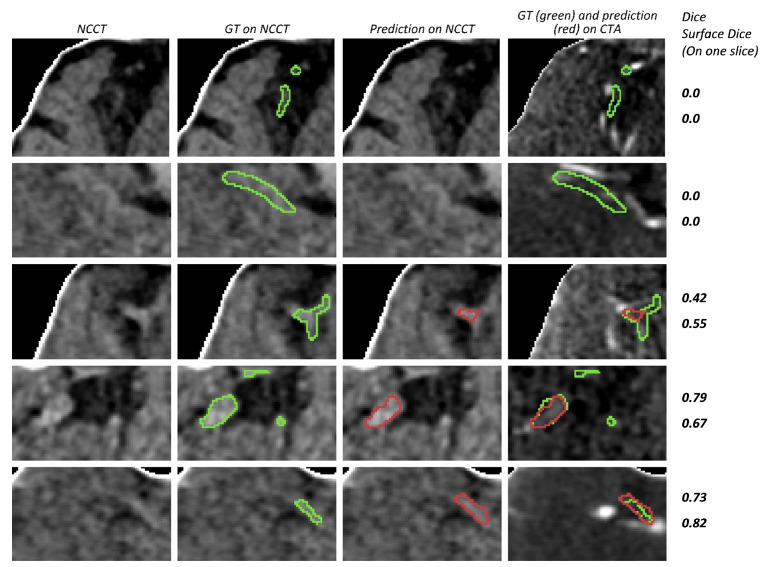 Figure 10