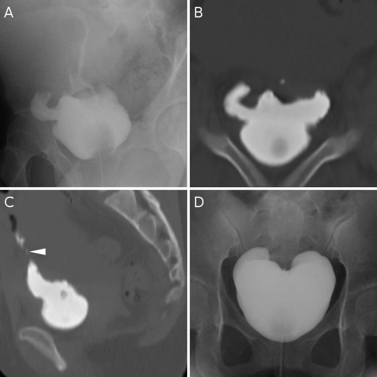 Fig. 5