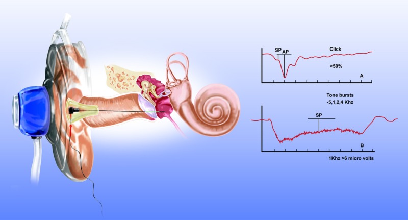 FIG. 1