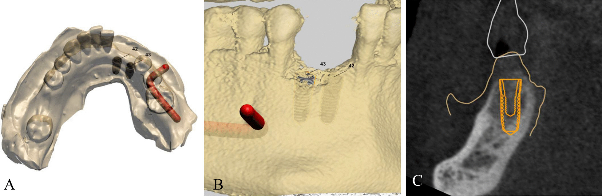 Fig. 1