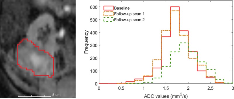 Fig 3