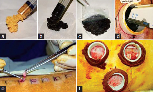 Figure 1: