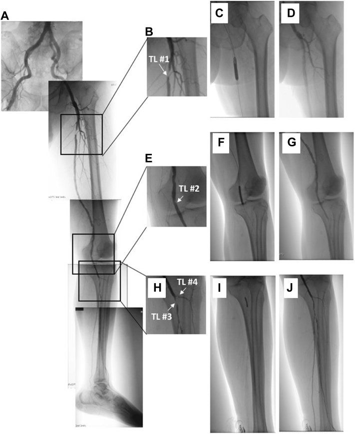 Fig 2