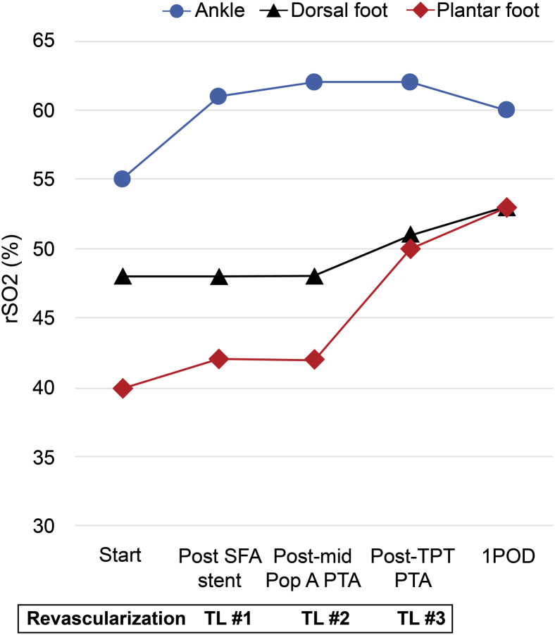 Fig 3