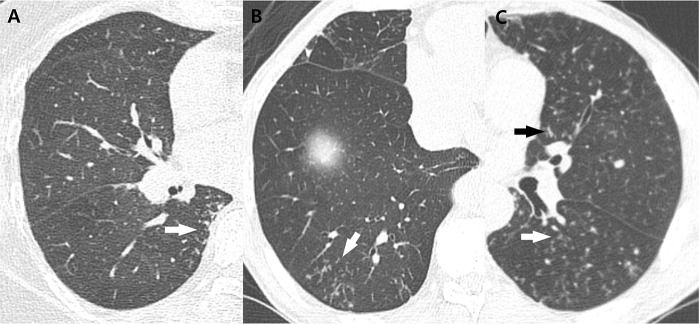 Fig 3