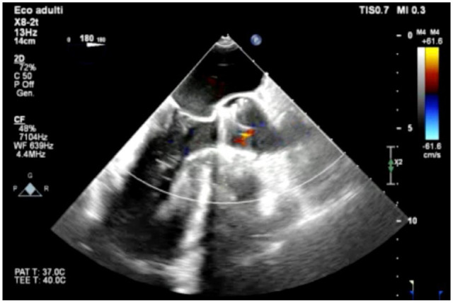 Fig. 2.