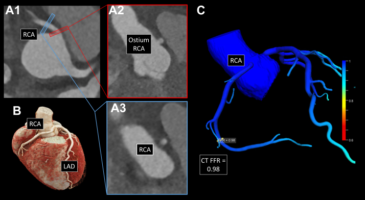 Figure 2