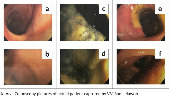 FIGURE 2