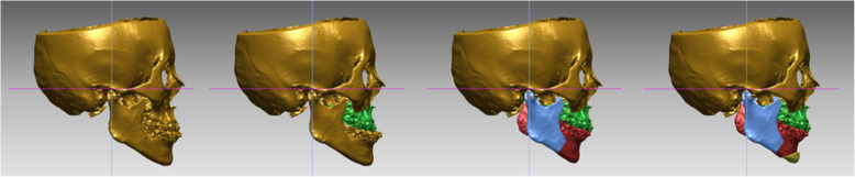 Fig. 2