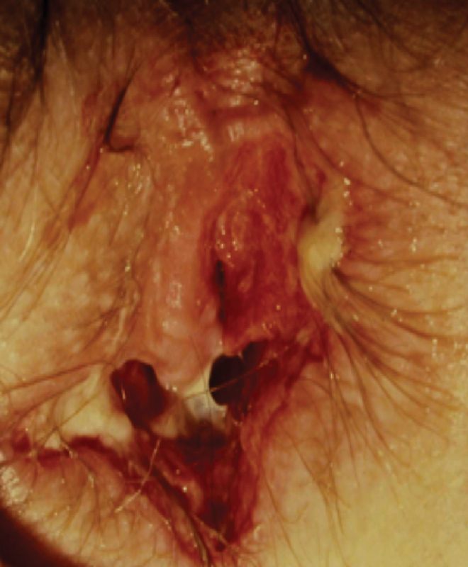 Fig. 10
