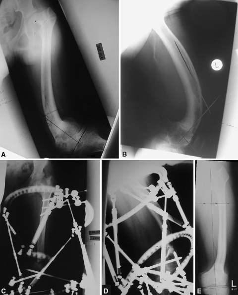 Fig. 2A–E