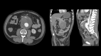 Fig. 1 –