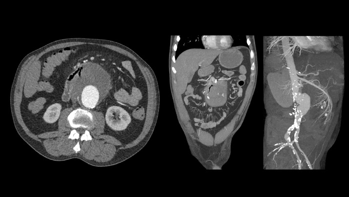Fig. 2 –