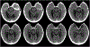 Fig 1.