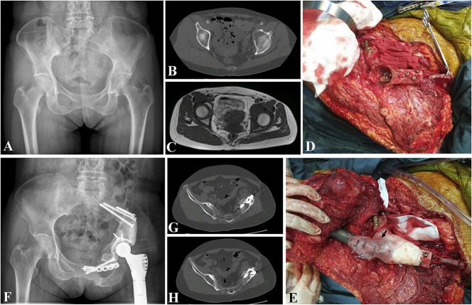 Fig. 2A-H